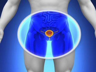سرطان پروستات دومین سرطان کشنده در مردان!
