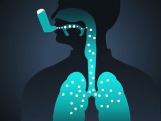 راهکارهای درمان درمان آسم آلرژیک