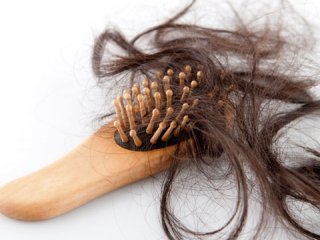 علل و انواع ريزش مو در زنان