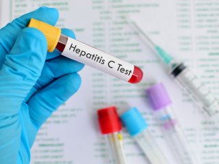 آنچه باید از هپاتیت C بدانیم (1)