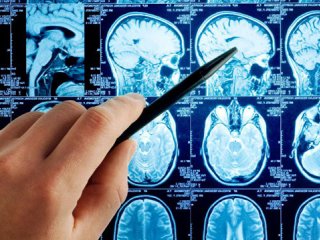 رایج‌ترین روش‌های تشخیص تومورهای مغزی