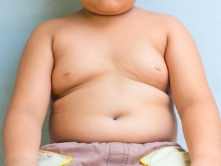پیامدهای اضافه وزن کودکان