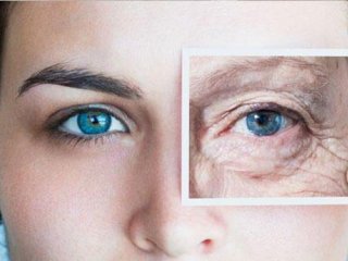 علایم پیر شدن پوست و روش های پیشگیری