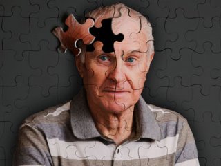 آلزایمر: تعریف، علل و تغذیه درمانی