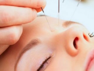 کاربرد طب سوزنی در جوانسازی پوست و مو