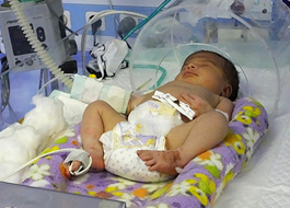غربالگری بيماری های متابوليك در نوزادان