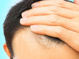 بسته موضوعی 109: ریزش مو، از علل تا درمان
