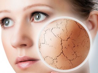 توصیه های  طلایی برای درمان خشکی پوست