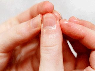 راهکاریی ساده برای درمان پوسته پوسته شدن نوک انگشتان