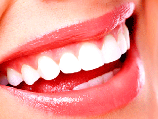 هزینه کامپوزیت دندان چقدر است؟