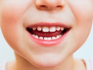 اثر وراثت در مشکلات دندانی و فک