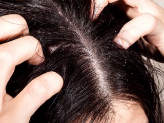 چگونه از چرب شدن مو ها جلوگیری کنیم؟