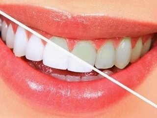 راز داشتن دندان های سالم و زیبا