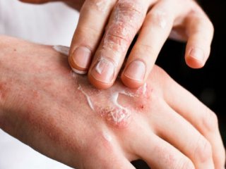 ۱۰ نکته مهم برای پیشگیری از خشکی پوست در فصل سرما