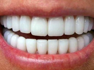 ۴ روش ساده برای جرم گیری دندان‌ها در منزل