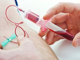 دانستنی‌های مهم درباره آزمایش خون