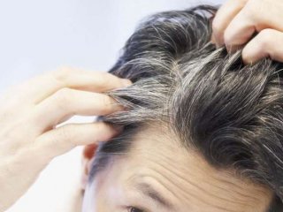 دلایل سفید شدن مو در سنین جوانی و راهکار درمان آن