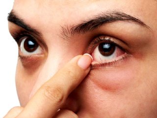 خشک‌شدن چشم چه دلایلی می‌تواند داشته باشد؟