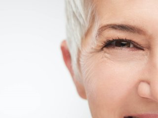 درمان چروک دور چشم با ۸ روش خانگی مؤثر