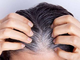 نسخه‌های طبیعی برای درمان ریزش و سفیدی مو