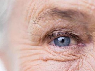 آنچه باید در مورد پیر شدن چشم‌ها بدانیم
