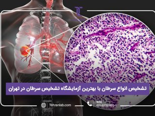 تشخیص انواع سرطان با بهترین آزمایشگاه تشخیص سرطان در تهران