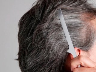 چهار راهکار برای کاهش سفیدی زودرس موی سر