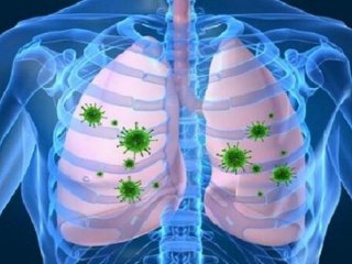 ممکن است ریه‌ها بدون علائم درگیر کرونا شوند؟