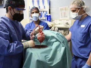 پیوند ناموفق قلب خوک به انسان، پس از دو ماه منجر به مرگ بیمار شد + عکس