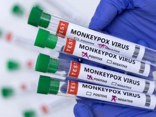 چه کسانی باید واکسن آبله میمون بزنند؟