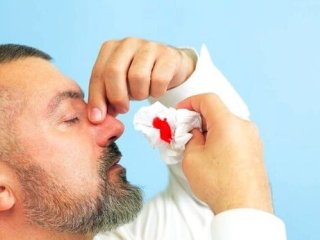 راه‌های جلوگیری از خونریزی بینی