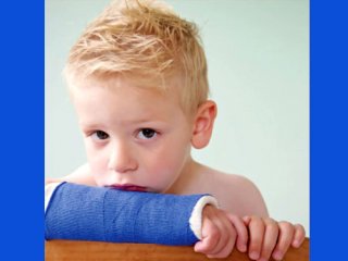 شکستگی‌های  رایج استخوانی در کودکان