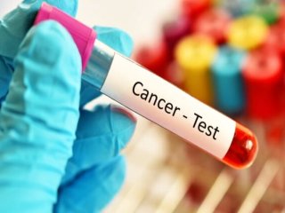 پوشش بیمه ۳ سرطان شایع در دستورکار ؛ برقراری پوشش آزمایشات HPV
