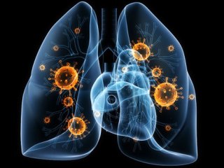 افزایش عفونت‌های تنفسی در کشور