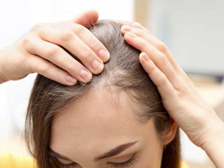 7 روش موثر برای درمان ریزش مو