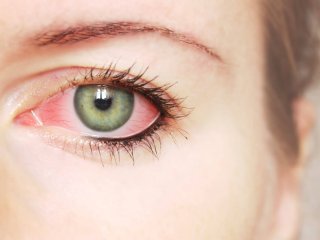 11 علامت عفونت چشم + اینفوگرافیک