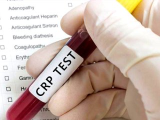 آزمایش CRP مثبت در کودکان