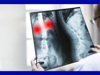 کارکردهای رادیوگرافی در تشخیص نارسایی های ریه