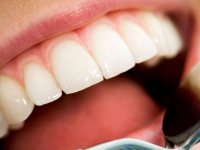 ۵ عادت نادرستی که دندان‌هایتان را خراب می‌کند