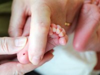 بیماری فنیل کتونوری و خطر عقب ماندگی ذهنی نوزاد