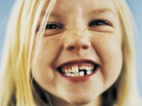 عوامل موثر بر دندان قروچه و درمان آن