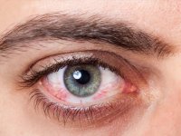 چشم پر‌خون نشانه چیست (1)