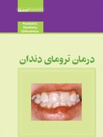 درمان ترومای دندان