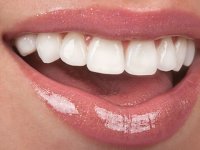 مروری برعفونت‌های دهانی هرپسی (1)