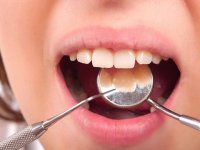 دندان‌ها از چه موادی پر می‌شوند (2)