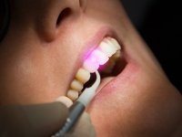راهنمای كمك به مصدوم در جراحات دهان و دندان