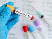 آنچه باید از هپاتیت C بدانیم (1)