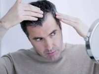 باورهای غلط تشخيص و درمان ريزش مو