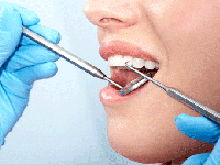 10 علت مهم پوسیدگی دندان