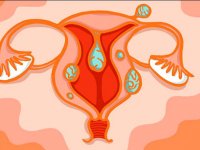 خطرات فیبروم در بارداری